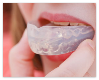 Mouth Guards Tmj 80